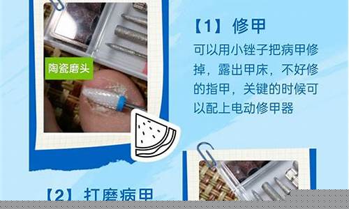 脱甲后抑菌液的成分-脱甲液使用安全吗