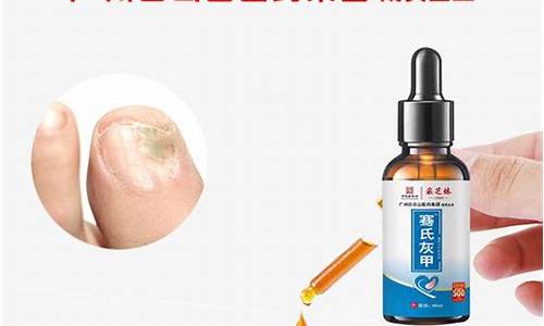 苦参抑菌剂怎么使用方法-苦参抑菌液灰指甲有用吗