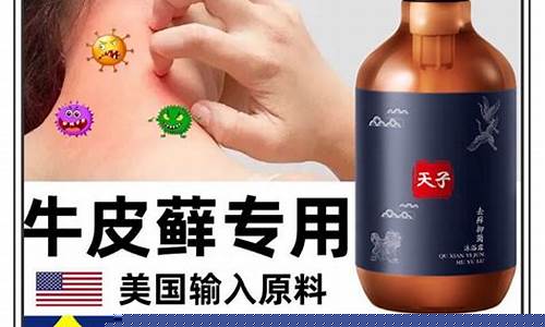 中药抑菌液沐浴露的功效-中药抑菌液沐浴露的功效与作用