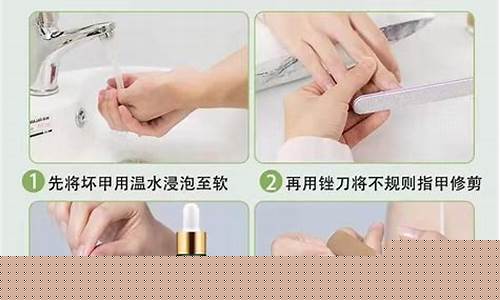 灰指甲抑菌液主要成分-灰指甲抑菌液价格