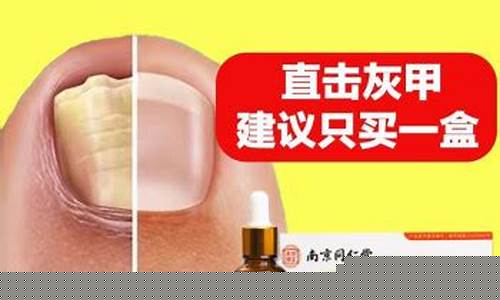同仁堂灰指甲药-同仁堂草本灰指甲抑菌液